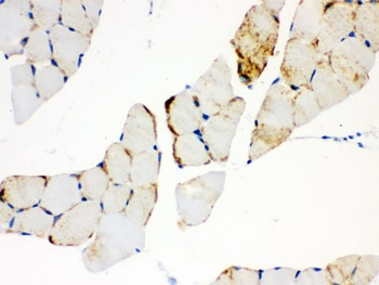IHC testing of FFPE mouse skeletal muscle and CPT1B antibody. HIER: Boil the paraffin sections in pH 6, 10mM citrate buffer for 20 minutes and allow to cool prior to staining.