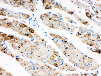 IHC testing of FFPE rat heart and CPT1B antibody. HIER: Boil the paraffin sections in pH 6, 10mM citrate buffer for 20 minutes and allow to cool prior to staining.