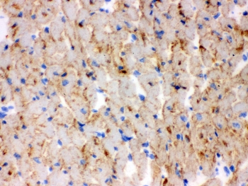 IHC testing of frozen mouse heart tissue with CPT1B antibody.