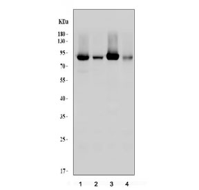Western blot testing of 1) rat heart, 2) rat skeletal muscle, 3) mouse heart, and 4) mouse skeletal muscle lysate wtih CPT1B antibody. Expected molecular weight ~88 kDa.