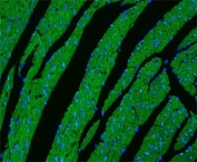 Immunofluorescent staining of FFPE mouse heart tissue with CPT1B antibody (green) and DAPI nuclear stain (blue). HIER: steam section in pH8 EDTA buffer for 20 min.