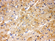 IHC testing of frozen rat heart tissue with CPT1B antibody. 