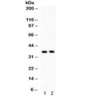 Western blot testing of human 1) PANC and 2) U87 cell lysate with FRZB antibody. Expected/observed molecular weight ~36 kDa.
