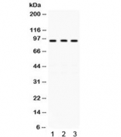Western blot testing of human 1) A431, 2) 22RV1 and 3) COLO320 lysate with GCN5 antibody. Expected/observed molecular weight ~94 kDa.