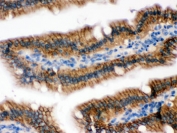 IHC testing of FFPE mouse intestine with UPF1 antibody. HIER: HIER: Boil the paraffin sections in pH8 EDTA buffer for 20 minutes and allow to cool prior to staining.