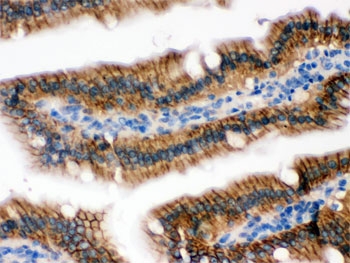 IHC testing of FFPE mouse intestine with UPF1 antibody. HIER: Boil the paraffin sections in pH 6, 10mM citrate buffer for 20 minutes and allow to cool prior to staining.