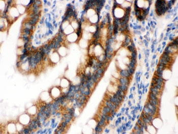 IHC testing of FFPE rat intestine with UPF1 antibody. HIER: Boil the paraffin sections in pH 6, 10mM citrate buffer for 20 minutes and allow to cool prior to staining.