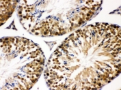 IHC testing of FFPE mouse testis with JAB1 antibody. HIER: Boil the paraffin sections in pH 6, 10mM citrate buffer for 20 minutes and allow to cool prior to staining.