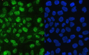 Immunofluorescent staining of FFPE human A431 cells with JAB1 antibody (green) and DAPI nuclear stain (blue). HIER: steam section in pH6 citrate buffer for 20 min.