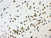 IHC testing of FFPE mouse brain with WNT2B antibody. HIER: Boil the paraffin sections in pH 6, 10mM citrate buffer for 20 minutes and allow to cool prior to staining.