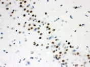 IHC testing of FFPE rat brain with WNT2B antibody. HIER: Boil the paraffin sections in pH 6, 10mM citrate buffer for 20 minutes and allow to cool prior to staining.