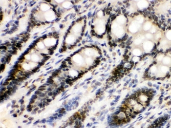 IHC testing of FFPE rat intestine with EME1 antibody. HIER: Boil the paraffin sections in pH 6, 10mM citrate buffer for 20 minutes and allow to cool prior to staining.