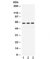 Western blot testing of human 1) HeLa, 2) Jurkat and 3) HUT lysate with EME1 antibody. Expected molecular weight ~63 kDa.
