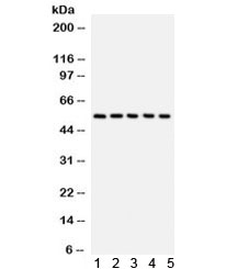 Western blot testing of 1) human placenta, 2) HeLa, 3) A549, 4) MM231, and 5) COLO320 lysate with CREB3L1 antibody. Predicted/observed molecular weight ~57 kDa.