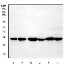 Western blot testing of 1) mouse lung, 2) mouse liver, 3) human SW620, 4) SMMC and 5) human placenta lysate using APH1A antibody. Expected/observed molecular weight: 27~29 kDa.