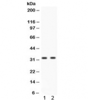 Western blot testing of human 1) HeLa and 2) A549 cell lysate with Livin antibody. Predicted molecular weight: 33/30 kDa (isoforms alpha/beta).