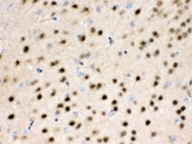 IHC testing of FFPE rat brain with HDAC11 antibody. HIER: Boil the paraffin sections in pH 6, 10mM citrate buffer for 20 minutes and allow to cool prior to staining.