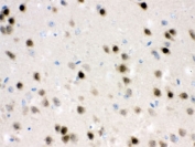 IHC testing of FFPE mouse brain with HDAC11 antibody. HIER: Boil the paraffin sections in pH 6, 10mM citrate buffer for 20 minutes and allow to cool prior to staining.