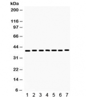 Western blot testing of  rat 1) skeletal muscle, 2) kidney, 3) heart, 4) NRK, and human 5) 293, 6) HeLa and 7) MCF7 lysate with HDAC11 antibody. Expected/observed molecular weight ~39 kDa.