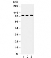 Western blot testing of 1) human HeLa, 2) Raji and 3) U937 lysate with ITCH antibody. Predicted molecular weight: ~99 kDa.