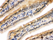 IHC testing of FFPE mouse intestine with UHRF2 antibody. HIER: Boil the paraffin sections in pH 6, 10mM citrate buffer for 20 minutes and allow to cool prior to staining.