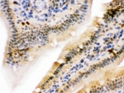 IHC testing of FFPE rat intestine with UHRF2 antibody. HIER: Boil the paraffin sections in pH 6, 10mM citrate buffer for 20 minutes and allow to cool prior to staining.