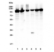 Western blot testing of human 1) HEK293, 2) T-47D, 3) A549, 4) HepG2, 5) MDA-MB-453 and 6) Raji cell lysate with UHRF1 antibody. Expected molecular weight: 91-106 kDa.