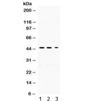 Western blot testing of 1) rat brain, 2) mouse brain, and 3) PANC lysate with Neuroserpin antibody. Expected/observed molecular weight ~46 kDa.