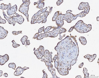 IHC staining of FFPE human placenta tissue with ATX2 antibody. HIER: boil tissue sections in pH8 EDTA for 20 min and allow to cool before testing.