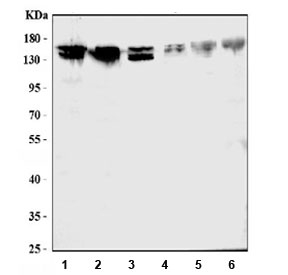 Western blot testing of human 1) HeLa, 2) K562, 3) A549, 4) rat brain, 5) mouse brain, and 6) mouse liver tissue lysate with ATX2 antibody. Expected molecular weight: 114~140 kDa.