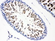 IHC testing of FFPE rat testis wtih CDC6 antibody. HIER: Boil the paraffin sections in pH 6, 10mM citrate buffer for 20 minutes and allow to cool prior to staining.