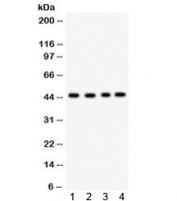 Western blot testing of 1) rat heart, 2) rat brain, 3) human HeLa and 4) human SMMC lysate with TSG101 antibody. Expected/observed molecular weight ~45 kDa.