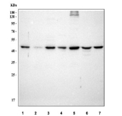 Western blot testing of 1) human HeLa, 2) human Jurkat, 3) human K562, 4) rat brain, 5) rat PC-12, 6) mouse brain and 7) mouse NIH 3T3 cell lysate with TSG101 antibody. Predicted molecular weight ~45 kDa.