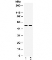 Western blot testing of 1) rat thymus and 2) human Jurkat lysate with VRK1 antibody. Predicted molecular weight ~45 kDa, observed here at ~55 kDa.