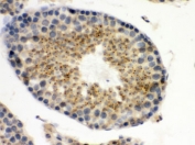 IHC testing of FFPE mouse testis with UPF3B antibody. HIER: Boil the paraffin sections in pH 6, 10mM citrate buffer for 20 minutes and allow to cool prior to staining.