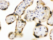 IHC testing of FFPE human placenta with UPF3B antibody. HIER: Boil the paraffin sections in pH 6, 10mM citrate buffer for 20 minutes and allow to cool prior to staining.