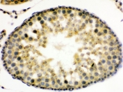 IHC testing of FFPE rat testis with UPF3B antibody. HIER: Boil the paraffin sections in pH 6, 10mM citrate buffer for 20 minutes and allow to cool prior to staining.