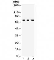 Western blot testing of human 1) MCF7, 2) A549 and 3) PANC lysate with ABCG5 antibody. Expected/observed molecular weight ~73 kDa.