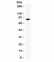 Western blot testing of human SMMC cell lysate with SMURF2 antibody. Expected/observed molecular weight ~86 kDa.