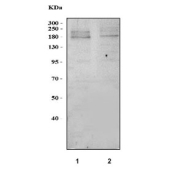 Western blot testing of 1) rat brain and 2) mouse brain tissue lysate with Otoferlin antibody. Predicted molecular weight: 226-227 kDa (long form, two isoforms), 140-149 kDa (short form, three isoforms).