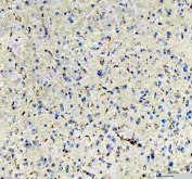 IHC testing of FFPE rat brain tissue with Otoferlin antibody. HIER: Boil the paraffin sections in pH 8 EDTA buffer for 20 minutes and allow to cool prior to staining.