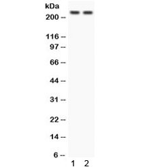 Western blot testing of 1) rat heart and 2) human 293 lysate with Otoferlin antibody. Predicted/observed molecular weight ~227 kDa.