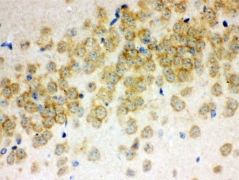 IHC testing of FFPE mouse brain with Otoferlin antibody. HIER: Boil the paraffin sections in pH 6, 10mM citrate buffer for 20 minutes and allow to cool prior to staining.