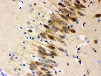 IHC testing of FFPE rat brain with Otoferlin antibody. HIER: Boil the paraffin sections in pH 6, 10mM citrate buffer for 20 minutes and allow to cool prior to staining.