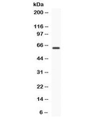 Western blot testing of human COLO320 cell lysate with TCF7L1 antibody. Expected/observed molecular weight ~63 kDa.~