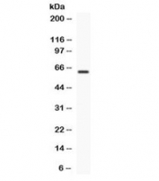 Western blot testing of human COLO320 cell lysate with TCF7L1 antibody. Expected/observed molecular weight ~63 kDa.