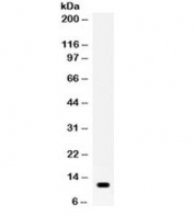 Western blot testing of human recombinant protein with Resistin antibody. Expected size: ~11 kDa.