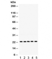 Western blot testing of 1) rat testis, 2) rat lung, 3) human 293, 4) human HeLa and 5) human HepG2 lysate with RAB18 antibody. Expected molecular weight ~23 kDa.