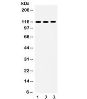 Western blot testing of 1) human 22RV1, 2) RH35 and 3) mouse NIH3T3 lysate with NLRC4 antibody. Expected/observed molecular weight ~116 kDa.