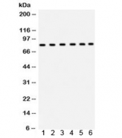 Western blot testing of rat 1) pancreas, 2) lung, 3) intestine, and human 4) SW620, 5) COLO320 and 6) 293 lysate with TRPV5 antibody. Predicted/observed molecular weight: ~83 kDa.